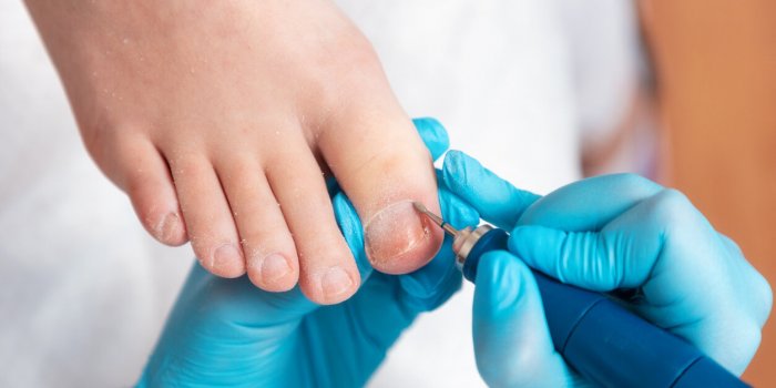 Consultation chez le podologue : prix, remboursement, soins, toutes les réponses aux questions que vous vous posez !Â