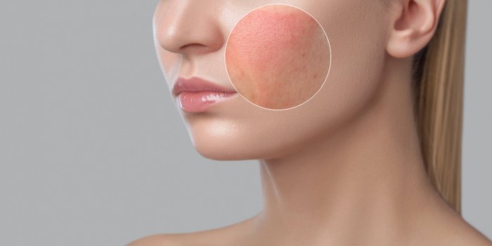 Coronavirus : 8 signes à repérer sur votre visage