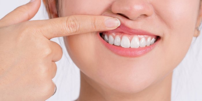 Comment savoir si on a un abcès dentaire : 7 symptômes à ne pas ignorer !
