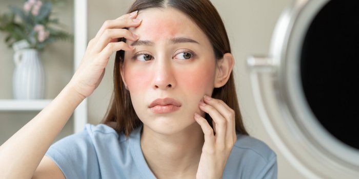 StÃ©atose hÃ©patique non alcoolique : 5 signes Ã  repÃ©rer sur le visage
