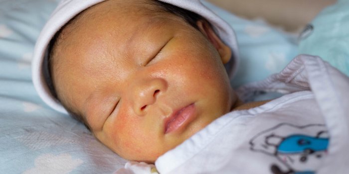 StÃ©atose hÃ©patique non alcoolique : 5 signes Ã  repÃ©rer sur le visage