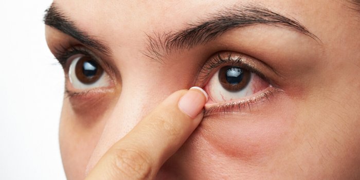 Cancer de l'Åil : 7 signes à ne pas négliger