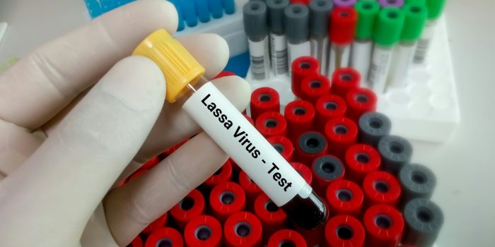 Pandémie : 9 virus qui inquiètent l'OMS