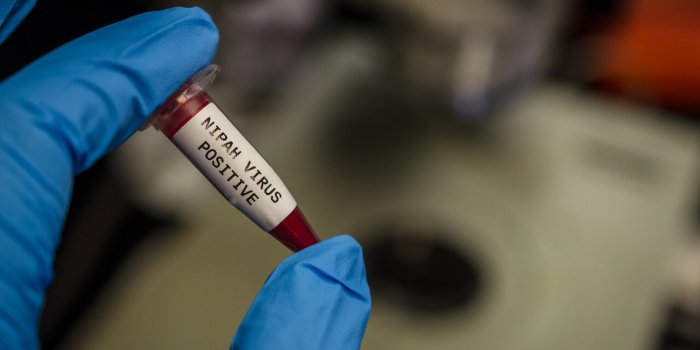 Pandémie : 9 virus qui inquiètent l'OMS