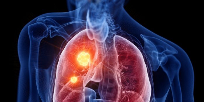 La liste noire des 93 mÃ©dicaments Ã  Ã©viter en 2021 selon la revue Prescrire