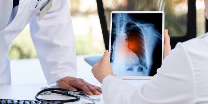 COVID long : les 5 différentes formes selon une infectiologue