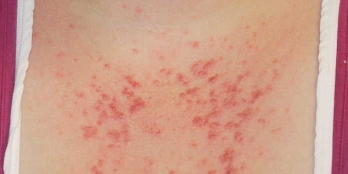 Parfum et soleil : 5 dangers que vous ignorez encore !