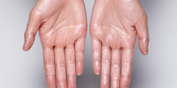 Syndrome douloureux rÃ©gional complexe : ces symptÃ´mes mÃ©connus qui accompagnent la douleur