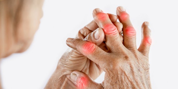 7 signes qui peuvent annoncer une maladie auto-immune 