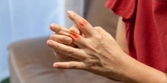 ObÃ©sitÃ© : les 7 maladies ostÃ©o-articulaires quâelle favorise