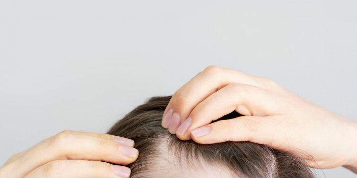 Ménopause : vos hormones affectent votre chevelure