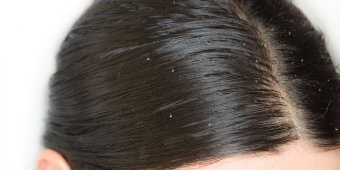 Ménopause : vos hormones affectent votre chevelure