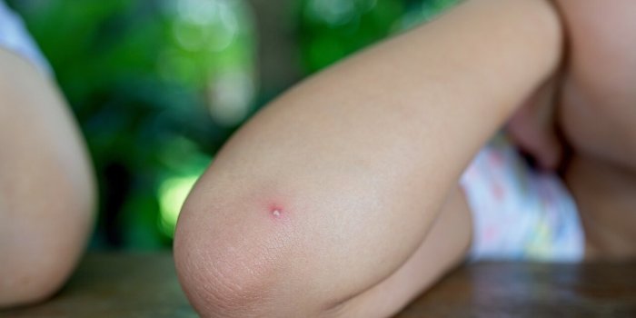 Peau : 5 symptômes cutanées qui peuvent révéler un problème de santé