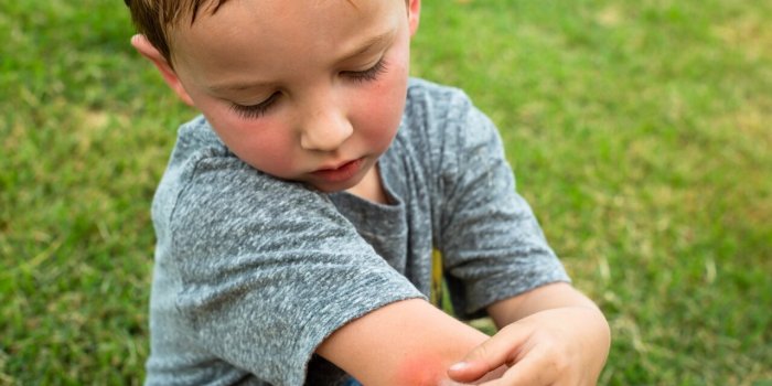 Peau : 5 symptômes cutanées qui peuvent révéler un problème de santé
