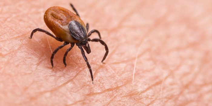 9 facteurs qui peuvent contribuer au dÃ©sÃ©quilibre de lâhistamine, cette molÃ©cule essentielle Ã  notre santÃ©
