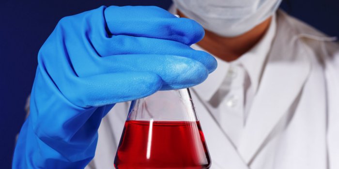 Urine : les couleurs qui doivent vous alerter