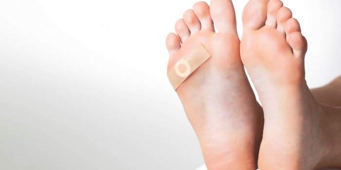woman's foot with glued medical plaster for plantar wart treatment of calluses and warts on the feet copy space for text