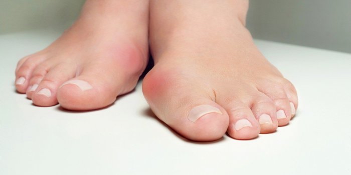 Pfizer et Moderna : certains développent "l'orteil Covid" après le vaccin