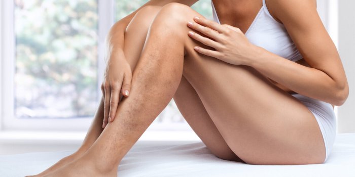 5 signes dâune mauvaise circulation sanguine selon un chirurgien