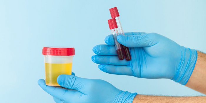 âNovembre au masculinâ 2024 : les urologues français répondent à vos questions sur le cancer de la prostate