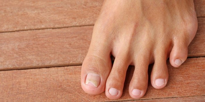 Cancer : plusieurs signes peuvent apparaitre sur vos ongles