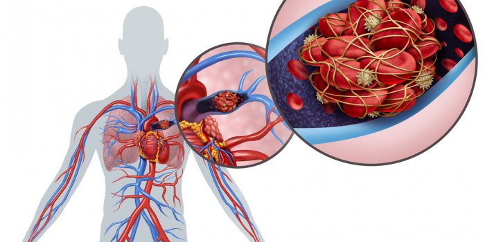 7 maladies qui ont les mêmes symptômes que la Covid-19