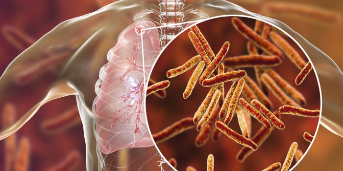 7 maladies qui ont les mêmes symptômes que la Covid-19