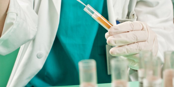 Urine nauséabonde : 11 maladies qu'elle peut révéler