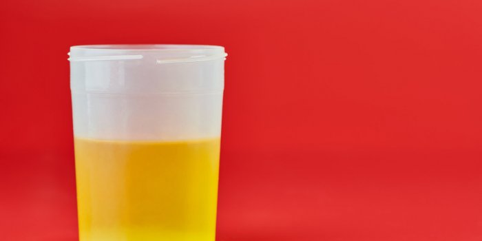 Urine nauséabonde : 11 maladies qu'elle peut révéler