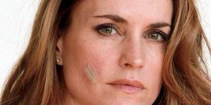 Carole Dechantre : "Après 5 biopsies de dépistage. Une est positive"