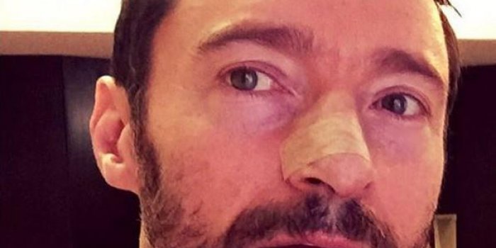 16 stars victimes du cancer