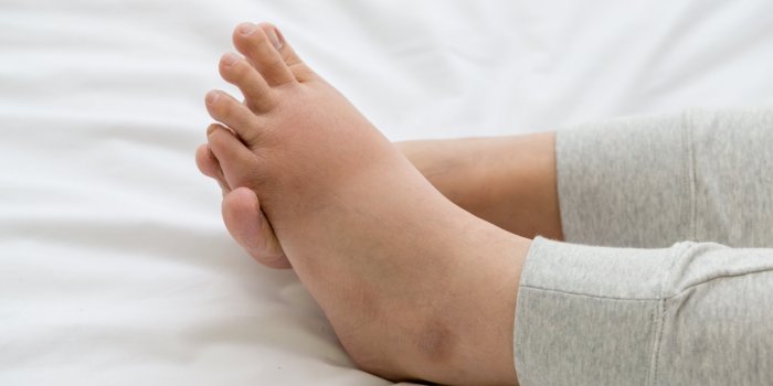 Alimentation : 8 signes que vous mangez trop salé