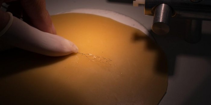 AVC, anévrisme⦠la fabrication des stents et des cathéters en images