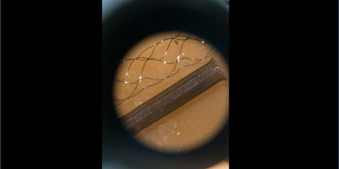 AVC, anévrisme⦠la fabrication des stents et des cathéters en images