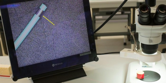 AVC, anévrisme⦠la fabrication des stents et des cathéters en images