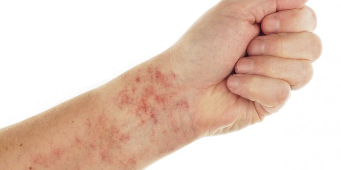 Pass sanitaire : certaines contre-indications vous dispensent du vaccin