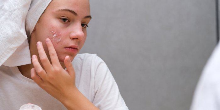 Peau : ce que ces 5 signes disent de votre santÃ©