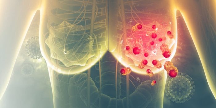 Les 10 cancers où l'obésité augmente les risques
