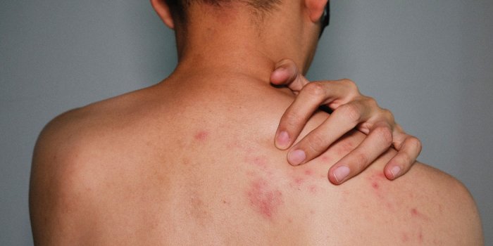 5 erreurs qui abîment la peau, selon un dermatologue
