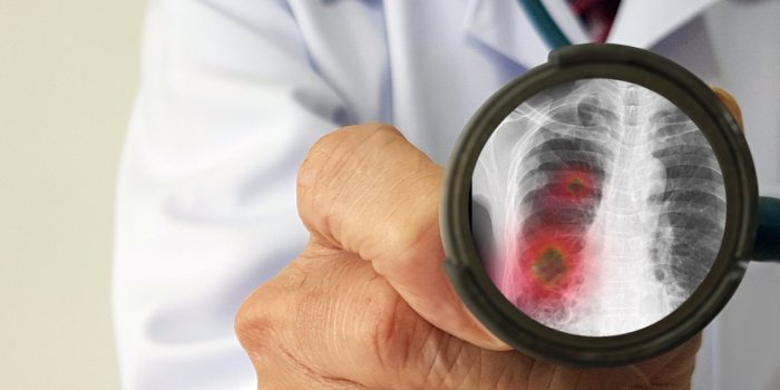 Toux persistante : 7 maladies graves qu'elle peut rÃ©vÃ©ler