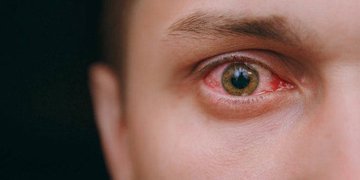 Masque : des symptÃ´mes inattendus en cas de port prolongÃ©