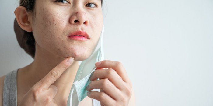 Masque : des symptÃ´mes inattendus en cas de port prolongÃ©