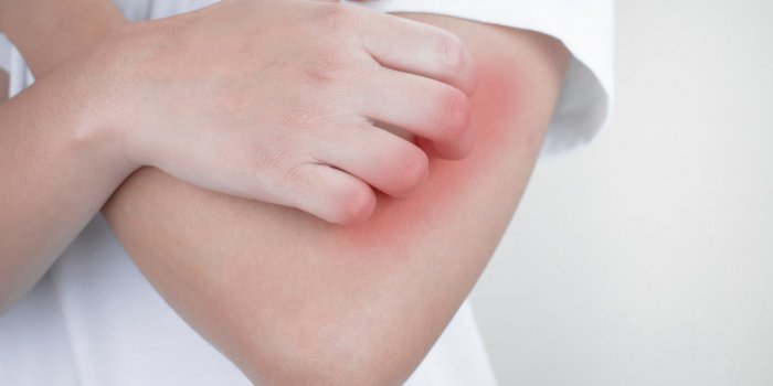 Vaccin Johnson & Johnson : Ã quels effets secondaires doit-on s'attendre ?