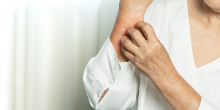 7 gestes de dermato à adopter dâurgence pour éviter peau sèche et eczéma en hiver