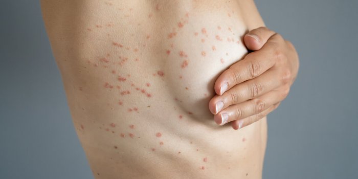 TouchÃ©e par le cancer depuis 13 ans : "N'ignorez pas ces changements sur votre corps"