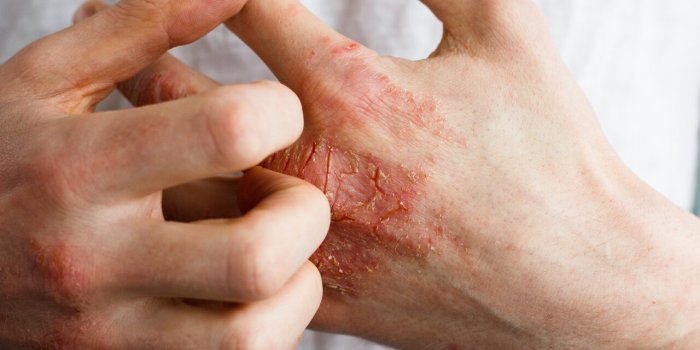 Eau du robinet : comment elle ruine votre peau et vos cheveux