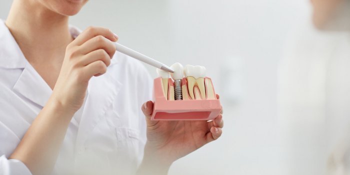 Arnaque dentaire : 7 astuces pour Ã©viter les dentistes malhonnÃªtes !