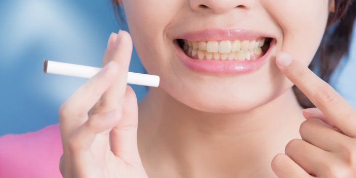 Comment prendre soin de ses gencives après 60 ans