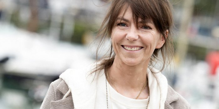 Vitiligo : Ces 7 cÃ©lÃ©britÃ©s qui brisent les tabous