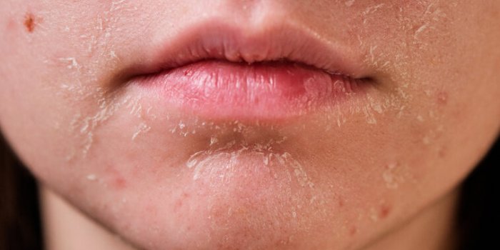 Hypothyroïdie : ces 5 signes ne trompent pas